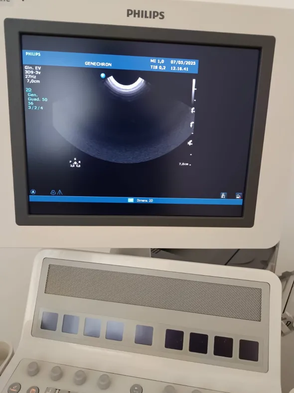 Ecografo Philips HD15 multidisciplinare