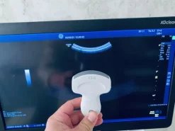 Ultrasuono GE Logiq E9 XDclear