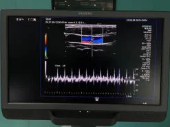 Ultrasuono SIEMENS ACUSON S2000 HELX Evoluzione