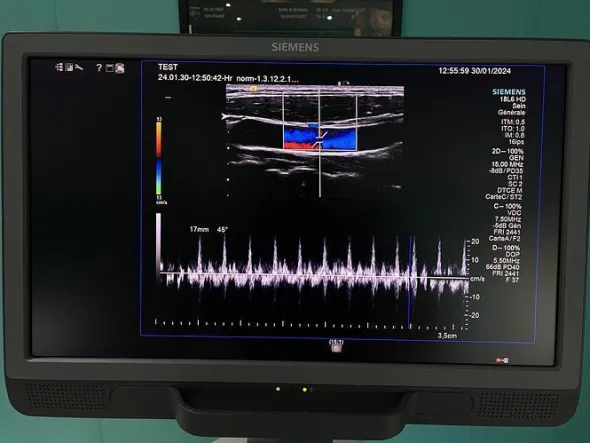 Ultrasuono SIEMENS ACUSON S2000 HELX Evoluzione